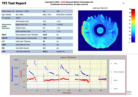 Image result for Test TFI Module