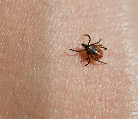 Ticks & Lyme Disease - Western UP Health Department