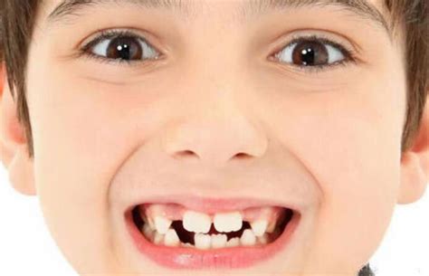 最全儿童换牙时间表：儿童换牙何时开始、何时结束？一图说清 | Foodlife