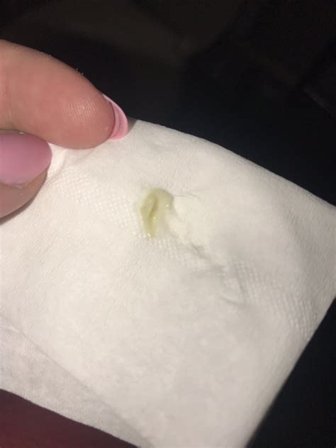 Pregnant With Green Discharge