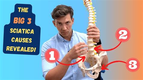 3 causes of fibromyalgia