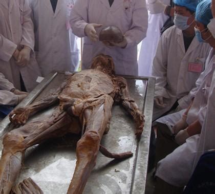 尸体解剖-中文百科在线图片查看
