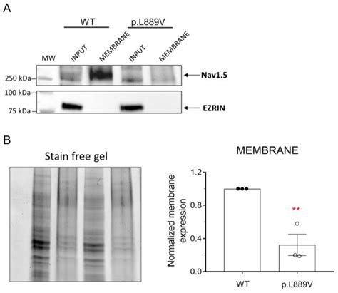 Variable Penetrance and Expressivity of a Rare Pore Loss-of-Function ...