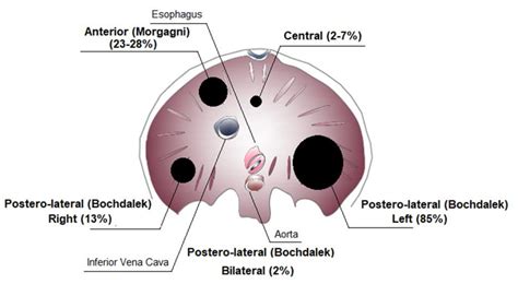 Congenital Diaphragmatic Hernia Types