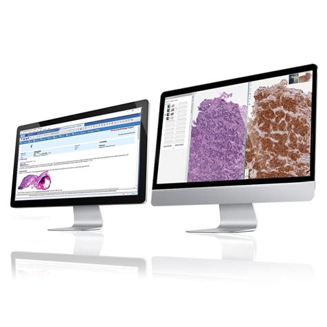 Image result for WinPath Pathology System