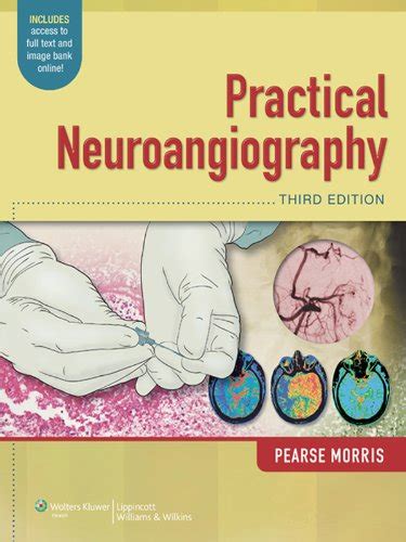 Practical Neuroangiography eBook : Morris, P. Pearse: Amazon.in: Kindle ...