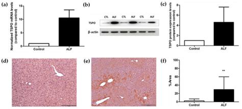 Application of TSPO-Specific Positron Emission Tomography Radiotracer ...