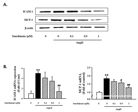 Sauchinone Protects Renal Mesangial Cell Dysfunction against ...