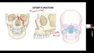 Ace Achievers Dental Academy