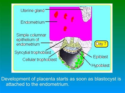 Placenta Development Notes Anatomy 的图像结果