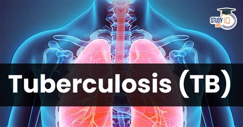Tuberculosis (TB), Symptoms, Causes and Treatment