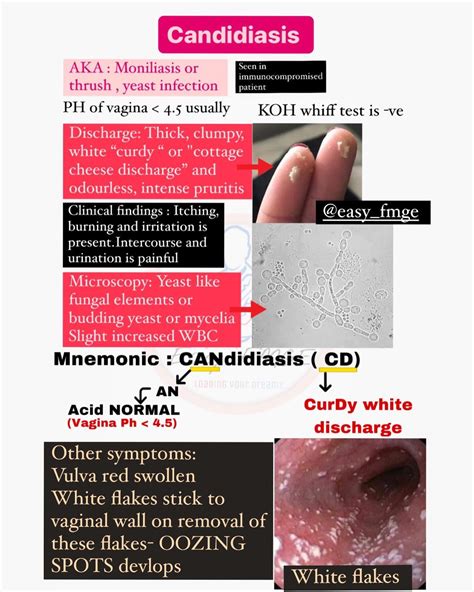 Clumpy Discharge 的图像结果