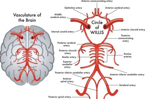 Brain Model Anatomy Management Of Chronic Occlusion Of Intracranial ...