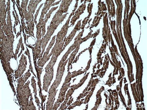 PYGB antibody (12075-1-AP) | Proteintech