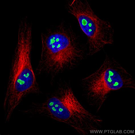 NAT10 antibody (13365-1-AP) | Proteintech