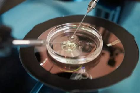 At 2 Millimetre Per Hour, Scientists Record The 'Speed Of Death' As It ...