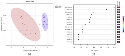 Comparative Targeted Metabolomics of Ischemic Stroke: Thrombi and Serum ...