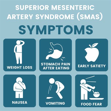 Getting SMAS-hed: A Guide for Learning Superior Mesenteric Artery ...