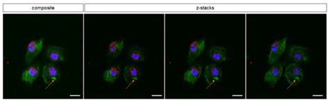 Cells | Special Issue : State-of-Art in Innate Immunity