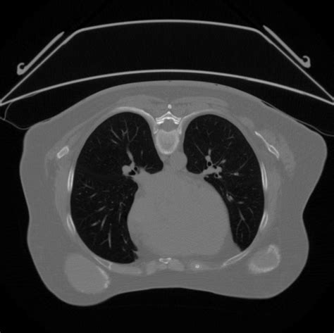 Image result for How to Extract Features From Nii Images in Python