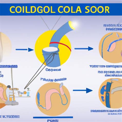 Image result for Colono Looping Colonoscopy