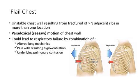 Trauma pada dada blunt chest trauma.pptx | First Aid | Injuries