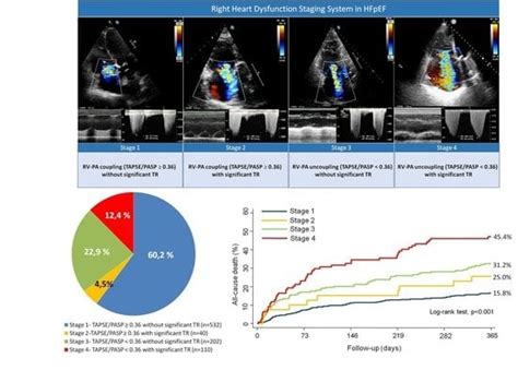 JCM | Special Issue : Epidemiology, Diagnosis, Pathophysiology, Risk ...