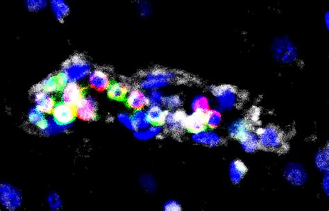 NIH study supports new approach for treating cerebral malaria ...