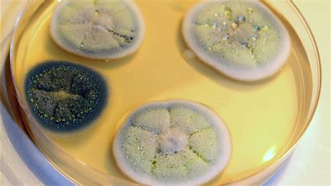 How Penicillin Was Discovered What Was Fleming S Hypothesis at Hazel Peterson blog
