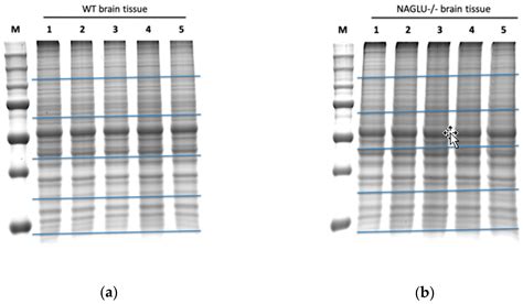 Proteomic Analysis of Mucopolysaccharidosis IIIB Mouse Brain