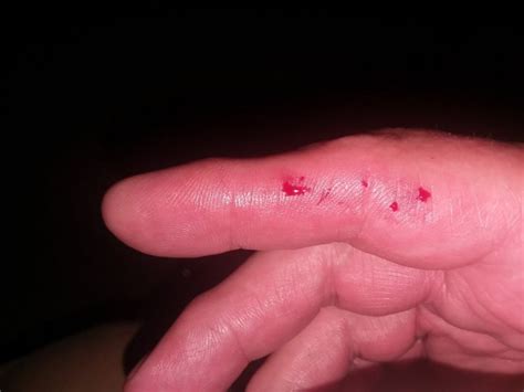 Image result for Retic Python Bite