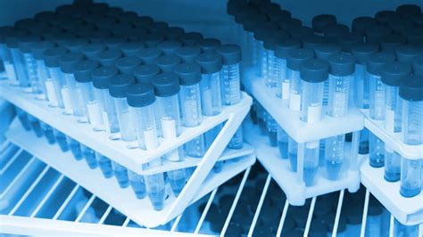 Local Storage Information Management 的图像结果