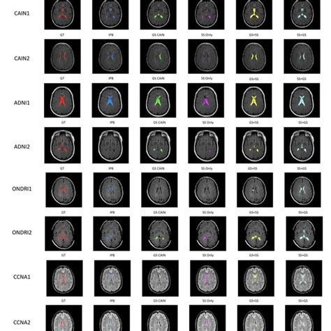 Image result for SS Executor Model