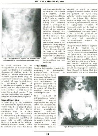 Image result for Bladder Explode