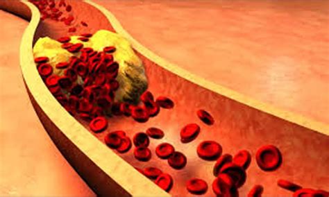 TyG index helps identify young CAD patients and predict their risk of ...