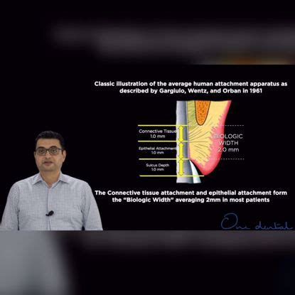Short videos: The OD Clinical Skills Program-One Dental is the Biggest ...