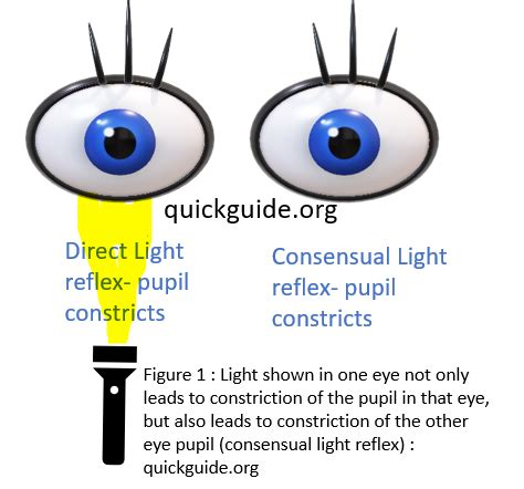 Image result for Pinpointer Im Test