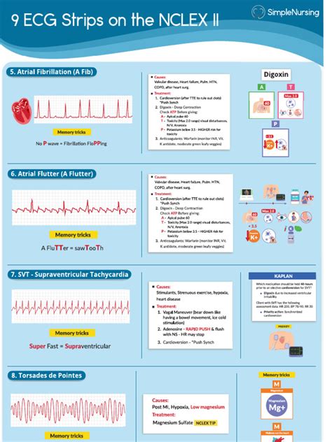 Basic EKG Class 的图像结果