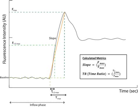 Image result for Time Intensity Compusense