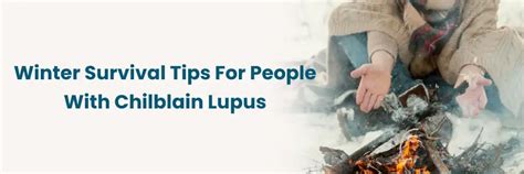 Chilblain Lupus Winter Care Tips