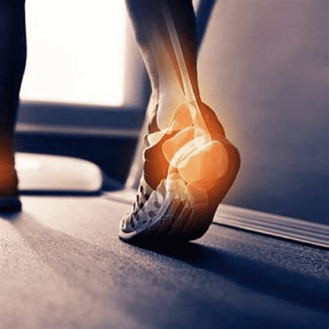 Top 3 Reasons for Heel Pain While Walking - JAWS podiatry