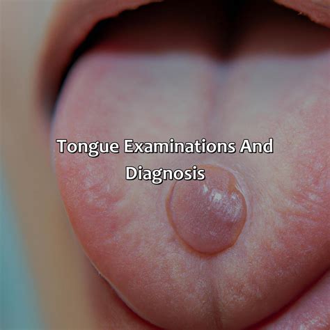 What Does The Color Of Your Tongue Mean - colorscombo.com