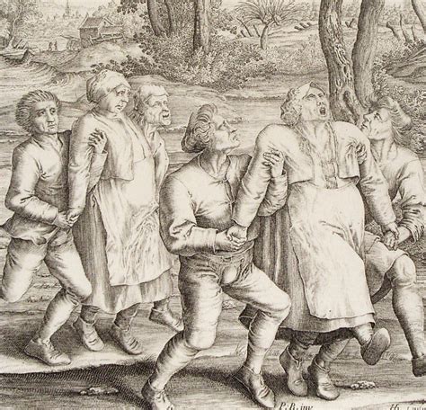 The Dancing Plague of 1518 - Past Medical History