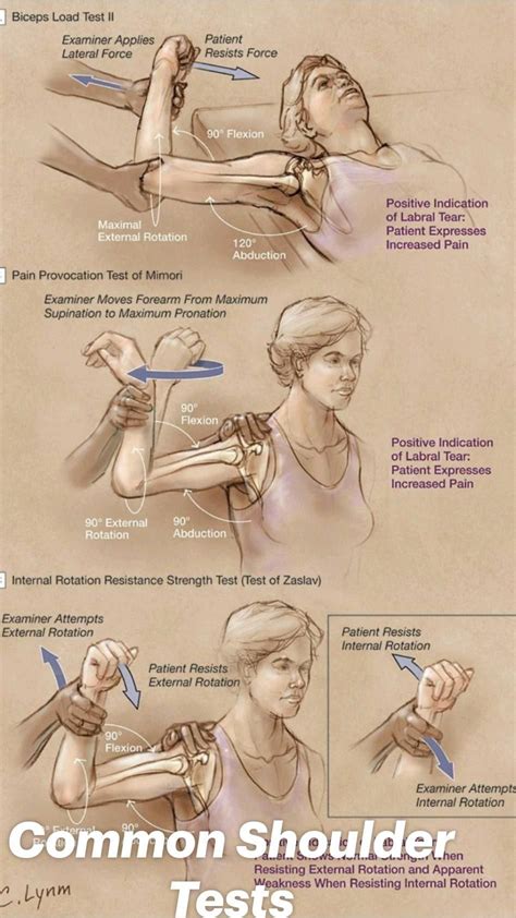 Rotator Cuff Muscles Test 的图像结果