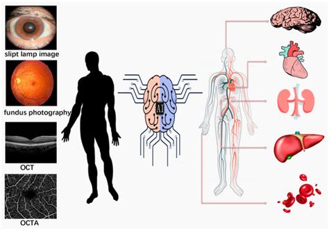 Diagnosing Systemic Disorders with AI Algorithms Based on Ocular Images