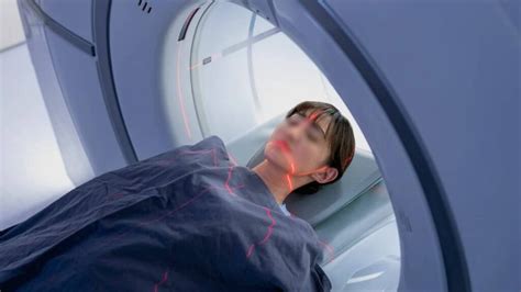 IRM Scanner 的图像结果