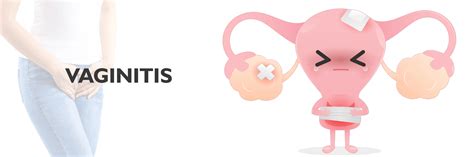 Vaginitis: tipos, síntomas, causas y opciones de tratamiento