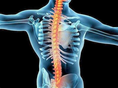 X 射线视图的脊柱疼痛-脊椎创伤高清摄影大图-千库网