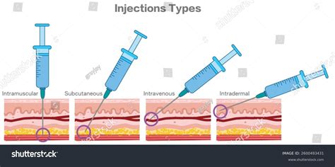 Angle of Injection 的图像结果