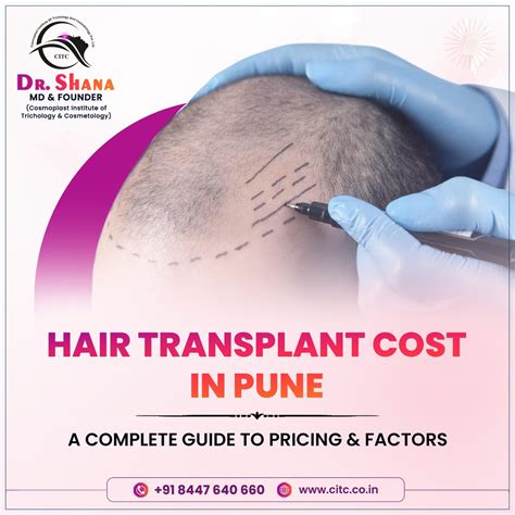 Hair Transplant Cost in Pune-CITC